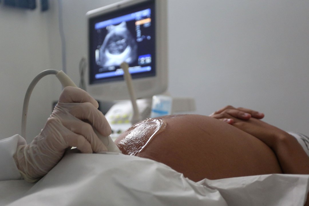 Una mujer embarazada, durante la realización de una ecografía.