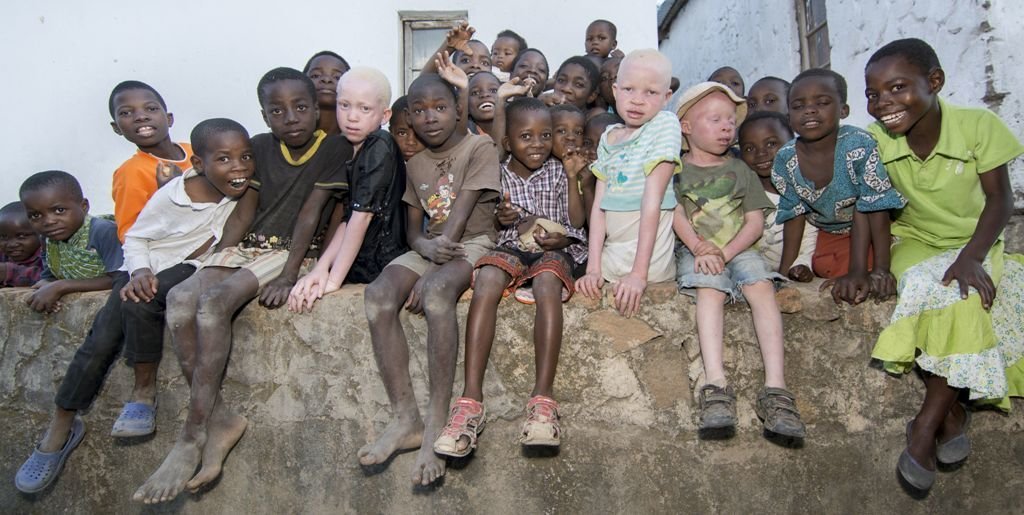 Niños que sufren albinismo, junto a otros de su misma edad, en Malaui.