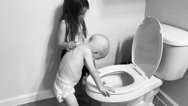 La imagen de una niña consolando a su hermano enfermo que ha conmovido a todo el mundo.