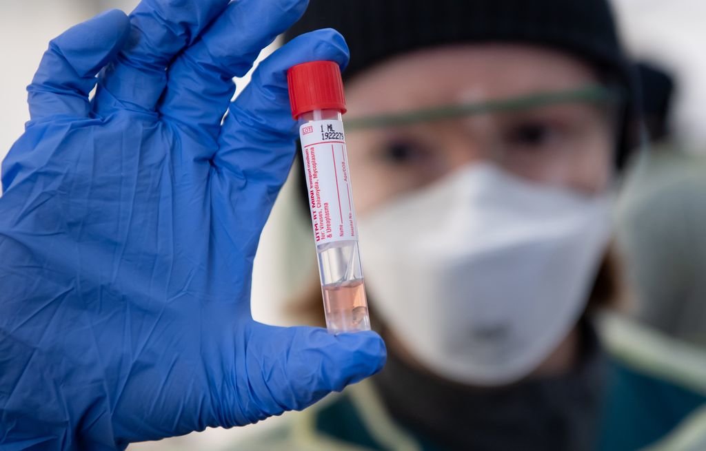 Un santiario muestra uno de los test de detección del coronavirus que utilizan en Alemania.