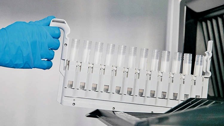 Un sanitario sostiene probetas para los test PCR en un laboratorio de análisis.