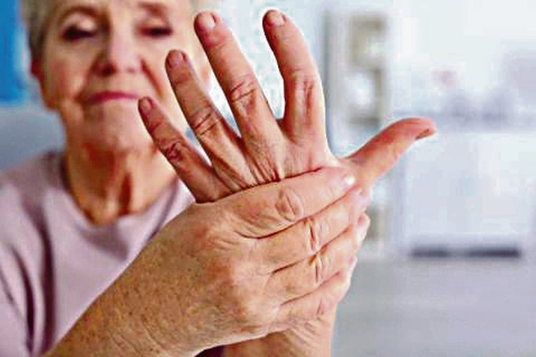 Una mujer experimenta dolor en las articulaciones de la mano a cauda de su artritis reumatoide.