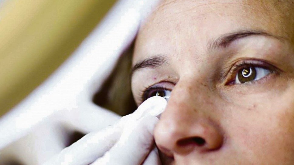 Tratamiento de ojo seco en el Área Oftalmológica Avanzada.