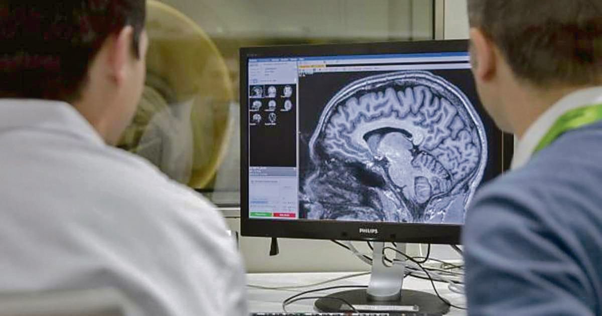 Doctores observando un escáner cerebral.