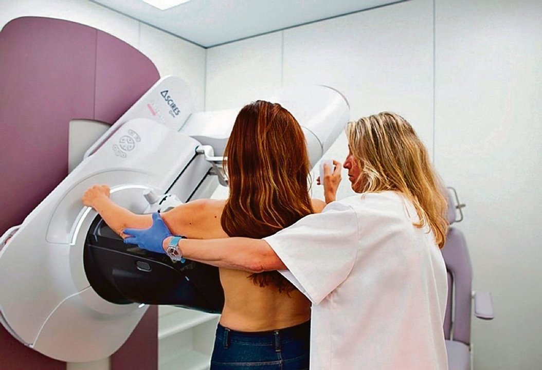 Una mujer se somete a una mamografía para prevenir el cáncer de mama.