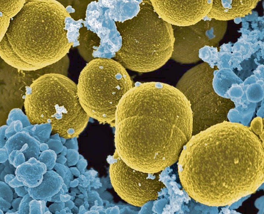 Bacterias S. Aureus escapando de la destrucción por células blancas humanas.