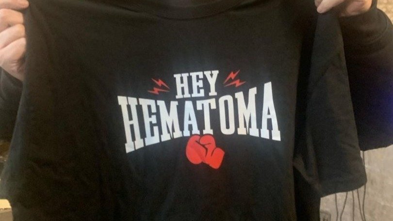 Miguel Costas mostró la camiseta de su nuevo grupo, Hey Hematoma.