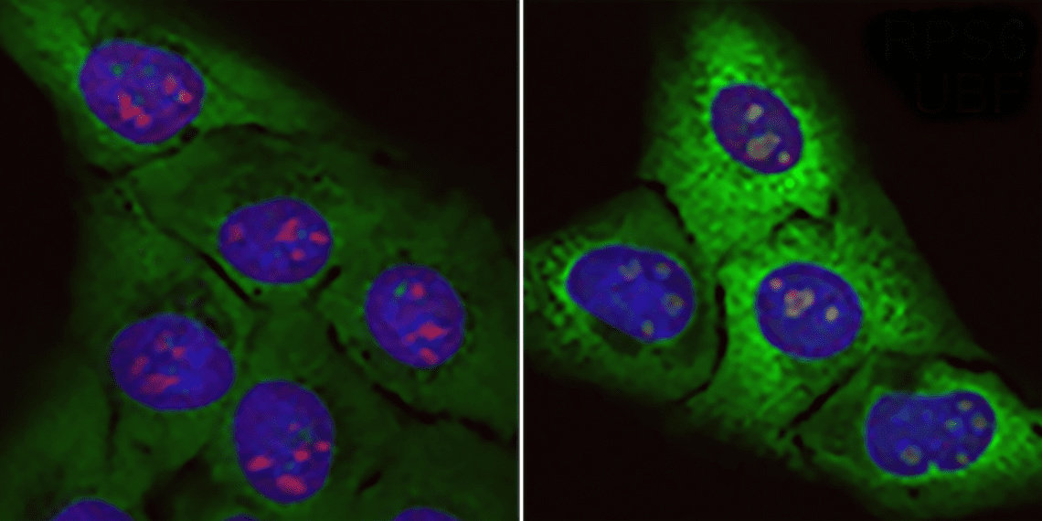 Acumulación de “proteínas basura”: Células normales (izquierda) y células sometidas al efecto de la proteína tóxica rica en arginina (derecha). // EP
