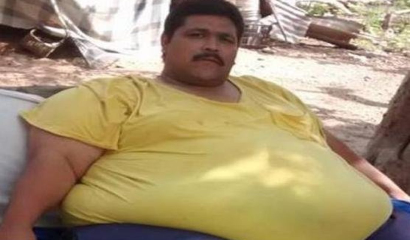 El hombre más obeso del mundo sueña con vida normal