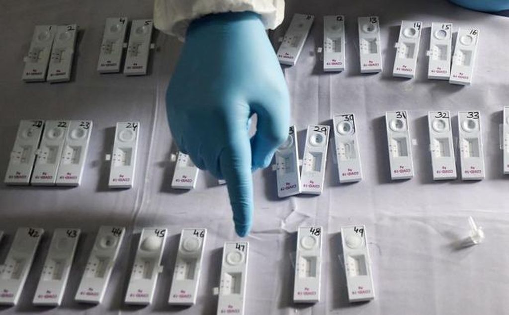 Quanto custam os testes de antígeno em outros países?